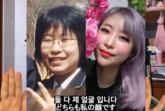 이세영 과거