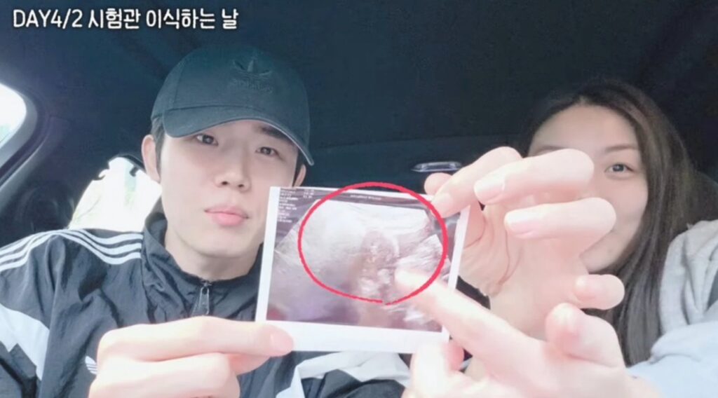 에일리 임신10