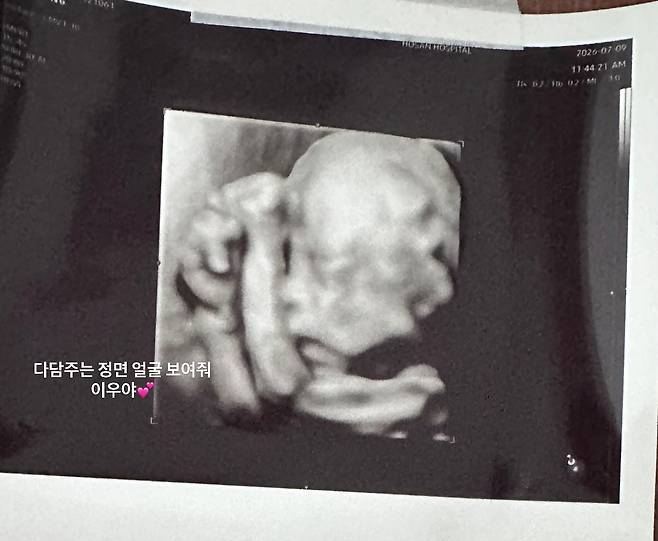 김민준 권다미 둘째 임신 소식! 태명 '삼든이' 뜻과 성별(딸), 10월 출산 정보 정리 11 lib 1783719607646 002 2